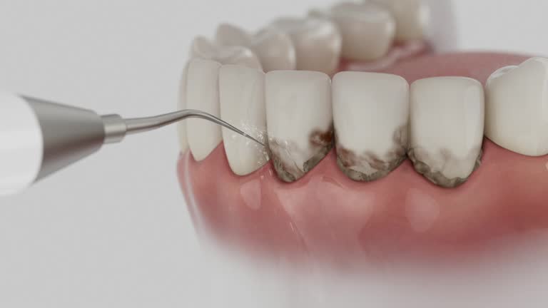 Reliable Emergency Dentist contractor in Tequesta, FL by Smile Center Dentistry